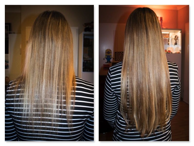 extensions